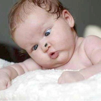 Cross-eyed baby with fly on nose